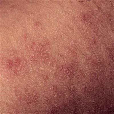 Dermatologie pédiatrique