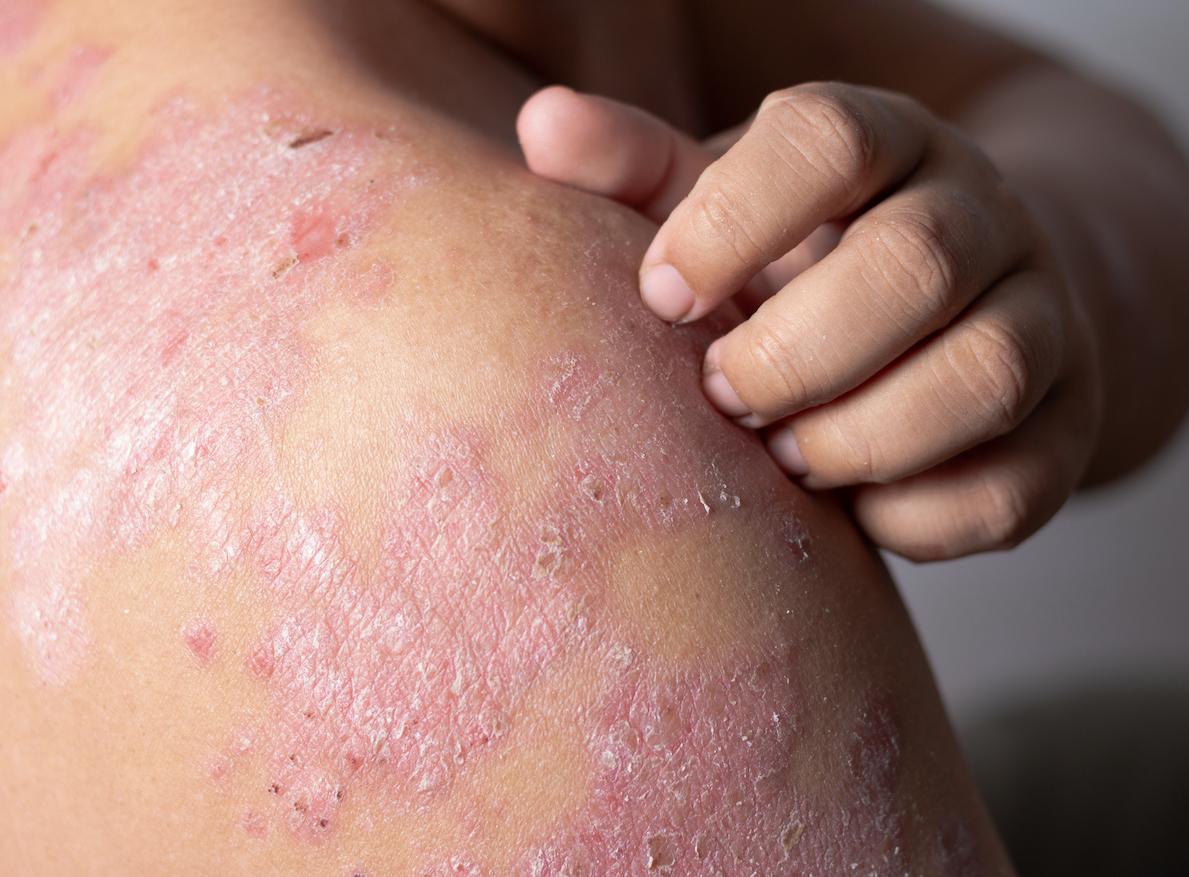 Examen dermatologique 4