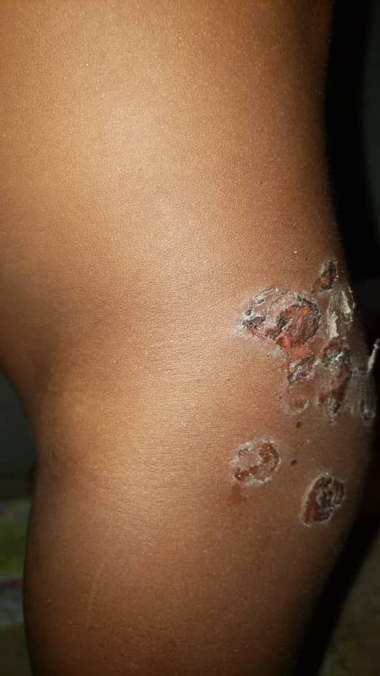 Dermatologie pédiatrique 2