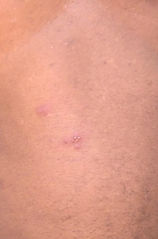 Dermatologie pédiatrique 4