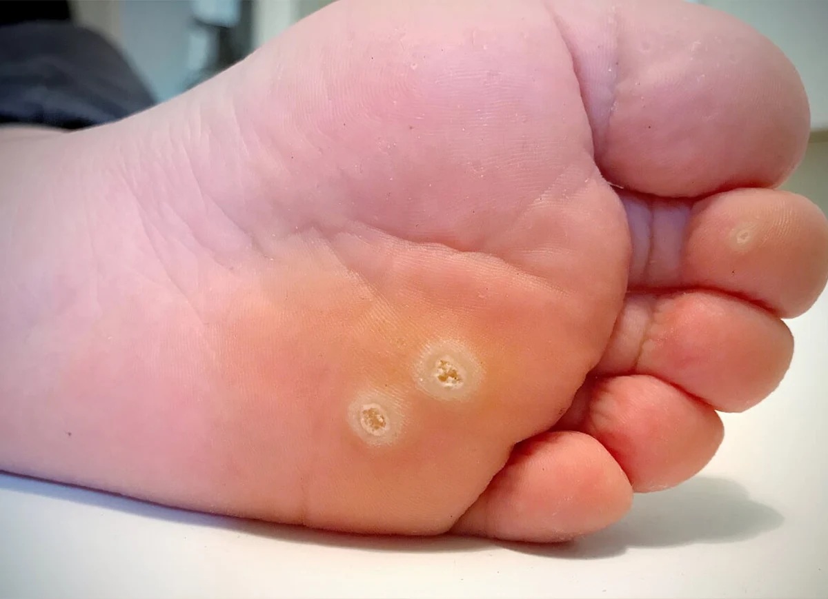 Dermatologie pédiatrique 3